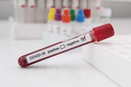 Антитела к коронавирусу имеют 16,5% жителей Югры