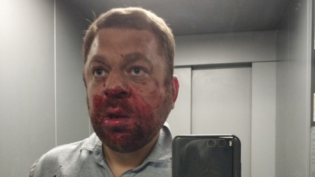 В ХМАО совершено нападение на общественного активиста, который делает расследования про югорских единороссов