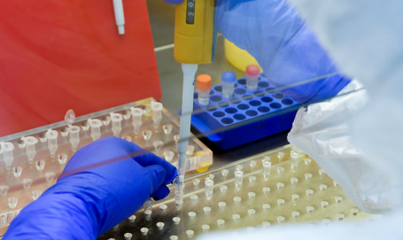 В ХМАО впервые зарегистрировано более тысячи заболевших коронавирусом за сутки